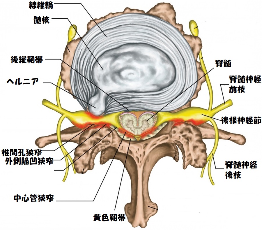 腰部脊柱管狭窄症の解剖